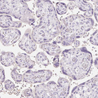 Immunohistochemical staining of human placenta shows no positivity in trophoblastic cells as expected.