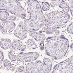 Immunohistochemical staining of human placenta shows no positivity in trophoblastic cells as expected.