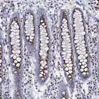 Immunohistochemical staining of human colon shows strong positivity in cytoplasm granular in glandular cells.