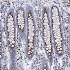 Immunohistochemical staining of human colon shows strong positivity in cytoplasm granular in glandular cells.