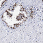 Immunohistochemical staining of human prostate shows strong positivity in cytoplasm granular in glandular cells.