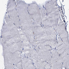 Immunohistochemical staining of human skeletal muscle shows no positivity in myocytes.