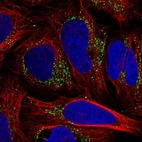 Immunofluorescent staining of human cell line U-2 OS shows localization to vesicles.
