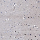 Immunohistochemical staining of human cerebral cortex shows strong nuclear positivity in neurons and weak cytoplasmic positivity in neuropil.