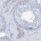 Immunohistochemical staining of human testis shows moderate nuclear positivity in Leydig cells with weak cytoplasmic positivity.