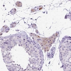 Immunohistochemical staining of human testis shows moderate cytoplasmic positivity in Leydig cells.
