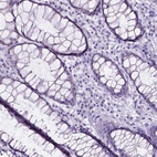 Immunohistochemical staining of human rectum shows no positivity in glandular cells as expected.