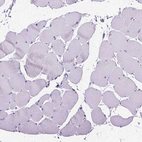 Immunohistochemical staining of human skeletal muscle shows no positivity in myocytes as expected.