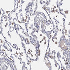 Immunohistochemical staining of human lung shows moderate membranous and cytoplasmic positivity in macrophages.