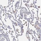 Immunohistochemical staining of human lung shows moderate membranous and cytoplasmic positivity in macrophages.