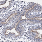 Immunohistochemical staining of human fallopian tube shows moderate membranous and cytoplasmic positivity in glandular cells.