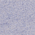 Immunohistochemical staining of human pancreas shows no positivity in exocrine glandular cells as expected.