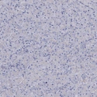 Immunohistochemical staining of human pancreas shows no positivity in exocrine glandular cells as expected.