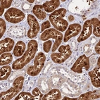 Immunohistochemical staining of human kidney shows strong cytoplasmic and nucleus positivity in cells in tubules.