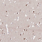 Immunohistochemical staining of human cerebral cortex shows strong cytoplasmic and nucleus positivity in neurons.