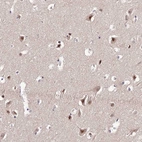 Immunohistochemical staining of human cerebral cortex shows strong cytoplasmic and nucleus positivity in neurons.