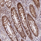 Immunohistochemical staining of human rectum shows strong cytoplasmic and nucleus positivity in glandular cells.