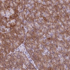 Immunohistochemical staining of human pancreas shows moderate membranous positivity in exocrine glandular cells.