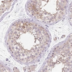 Immunohistochemical staining of human testis shows moderate membranous positivity in cells in seminiferous ducts.
