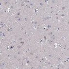 Immunohistochemical staining of human cerebral cortex shows weak cytoplasmic positivity in neuronal cells.