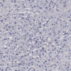 Immunohistochemical staining of human liver shows negative positivity in hepatocytes as expected.