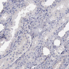 Immunohistochemical staining of human kidney shows negative positivity in cells in tubules as expected.