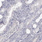 Immunohistochemical staining of human kidney shows negative positivity in cells in tubules as expected.