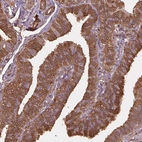 Immunohistochemical staining of human fallopian tube shows strong cytoplasmic and membranous positivity in glandular cells.