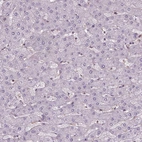 Immunohistochemical staining of human liver shows no positivity in hepatocytes as expected.