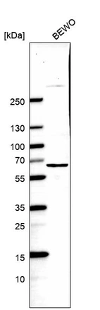 Western blot analysis in human cell line BEWO.