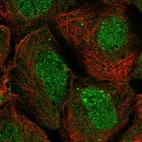 Immunofluorescent staining of human cell line HEK 293 shows localization to nucleus & cytosol.