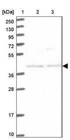 Lane 1: Marker [kDa] 250, 130, 95, 72, 55, 36, 28, 17, 10_br/_Lane 2: Human cell line RT-4_br/_Lane 3: Human cell line U-251MG sp