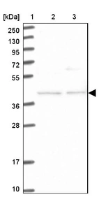 Lane 1: Marker [kDa] 250, 130, 95, 72, 55, 36, 28, 17, 10_br/_Lane 2: Human cell line RT-4_br/_Lane 3: Human cell line U-251MG sp