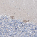 Immunohistochemical staining of human cerebellum shows moderate cytoplasmic positivity in Purkinje cells.