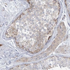 Immunohistochemical staining of human testis shows weak cytoplasmic and nuclear membranous positivity in cells in seminiferous ducts.