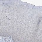 Immunohistochemical staining of human cervix, uterine shows no positivity in squamous epithelial cells.
