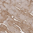 Immunohistochemical staining of human skeletal muscle shows moderate cytoplasmic positivity in myocytes.