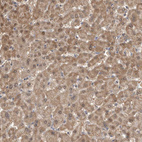 Immunohistochemical staining of human liver shows moderate cytoplasmic positivity in hepatocytes.