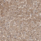 Immunohistochemical staining of human liver shows moderate cytoplasmic positivity in hepatocytes.