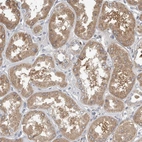 Immunohistochemical staining of human kidney shows moderate cytoplasmic positivity in cells in tubules.