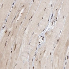 Immunohistochemical staining of human skeletal muscle shows strong nuclear positivity in myocytes.