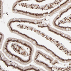 Immunohistochemical staining of human duodenum shows strong nuclear positivity in glandular cells.