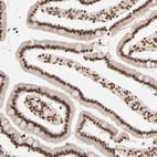 Immunohistochemical staining of human duodenum shows strong nuclear positivity in glandular cells.