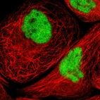 Immunofluorescent staining of human cell line A-431 shows localization to nucleoplasm.