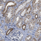 Immunohistochemical staining of human kidney shows strong cytoplasmic positivity in cells in tubules.