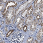 Immunohistochemical staining of human kidney shows strong cytoplasmic positivity in cells in tubules.