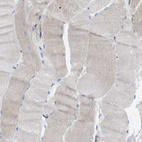 Immunohistochemical staining of human skeletal muscle shows no positivity in myocytes as expected.