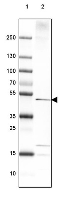 Lane 1: Marker [kDa] 250, 130, 100, 70, 55, 35, 25, 15, 10_br/_Lane 2: Human cell line RT-4