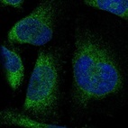 Immunofluorescent staining of human cell line U-251 MG shows localization to endoplasmic reticulum.