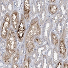 Immunohistochemical staining of human kidney shows strong membranous cytoplasmic positivity in cells in tubules.